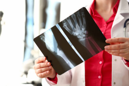 Female radiologist hold in hand x-ray film image aganist hospital office background. CT scan of bone health concept.